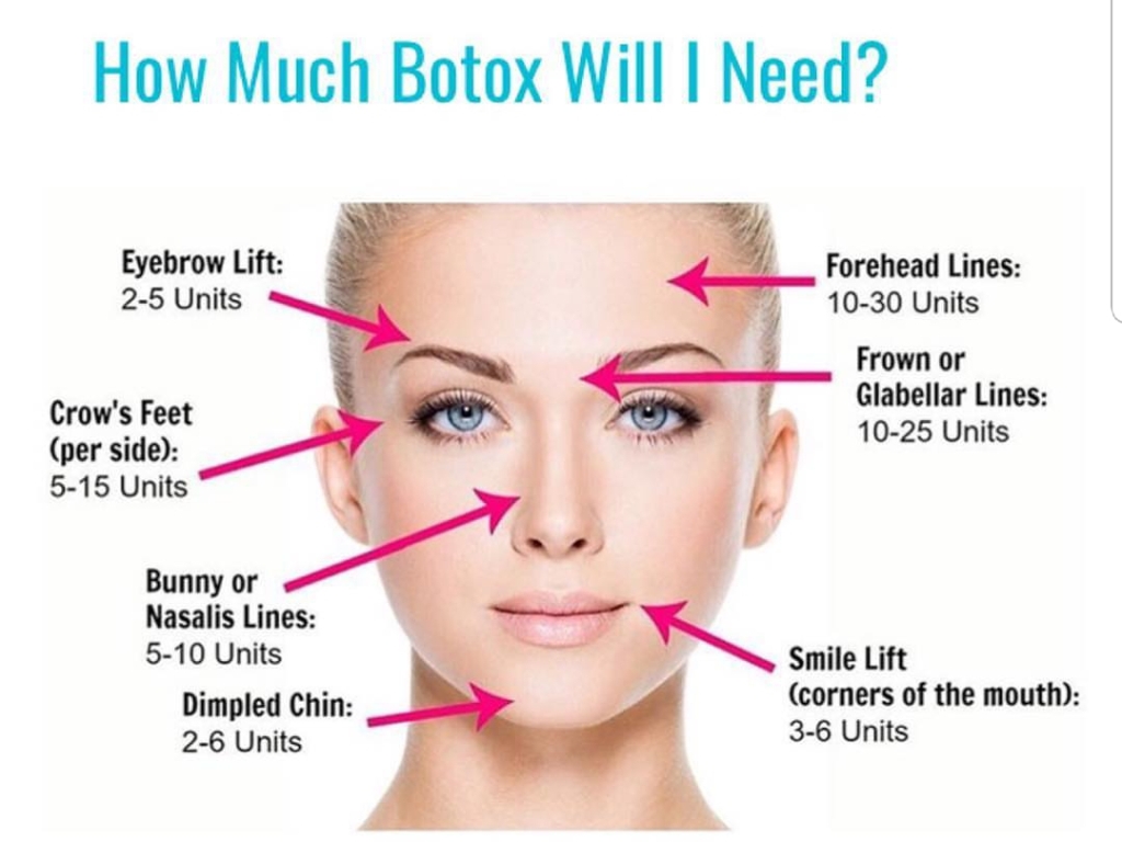 Botox 20 Units of Botox $99